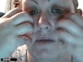 Review Skin Renew Part 1 Review Skin Renew Part 1