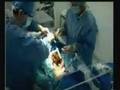Alcor Foundation ( Cryonics ) Part.C ( Ted WILLIAMS )