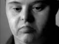Down syndrome:&nbsp;S�ndrome de Down: Diferente