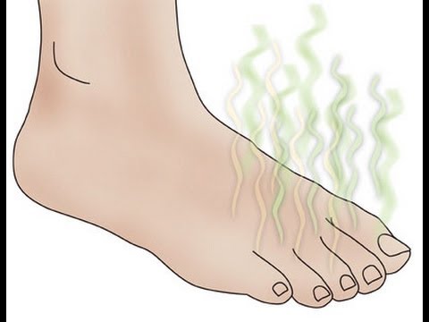 how to relieve bad foot odor