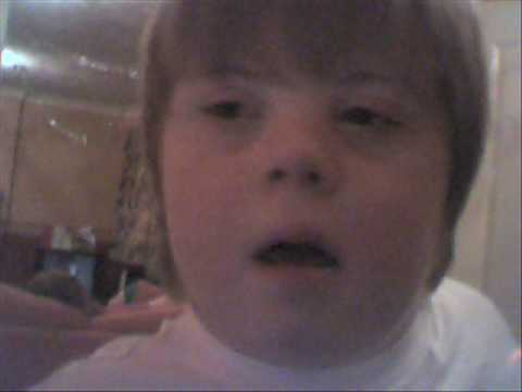 down syndrome
