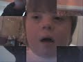 down syndrome down syndrome