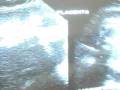 videos de EMBARAZO 29 SEMANAS-PREGNANCY 29 WEEKS - IT´S A GIRL !!