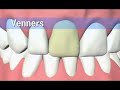 DENTAL SUPPLY IN MIAMI GINY USA DENTAL SUPPLY IN MIAMI GINY USA