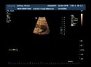 baby-cathey-12-weeks.html