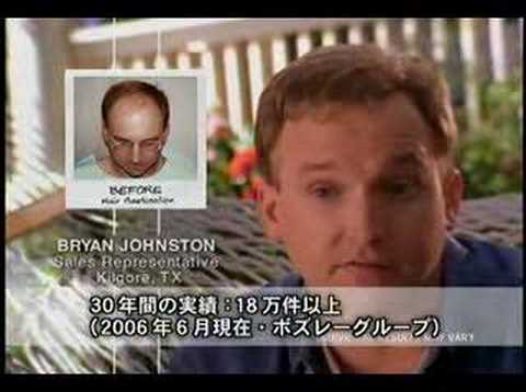 薄毛大集合！徹底討論会Youtube(ユーチューブ・ゆーちゅーぶ)・Dailymotion動画
