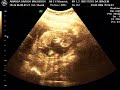 nosso bebê1 nosso bebê1