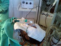 operating intestinal obstruction operating intestinal obstruction