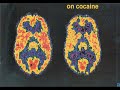 stop to the drug