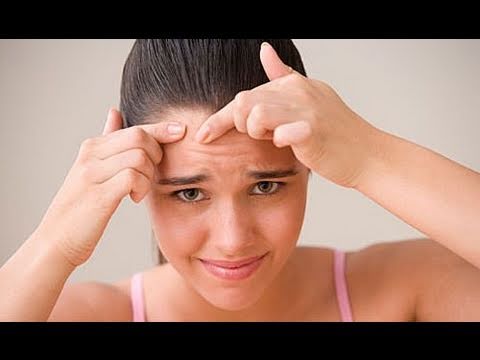 Dealing with Adult Acne