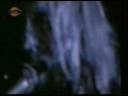 La Renga - El rito de los corazones sangrando (Video Clip)