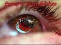ertugrul malatya s�mer mhp �lk�c� kurt bozkurt