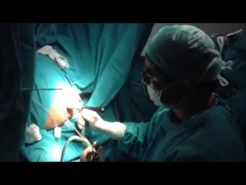 how to examine av fistula