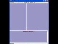TeamSpeak - 9-J�hriges Kind am behindert sein^^