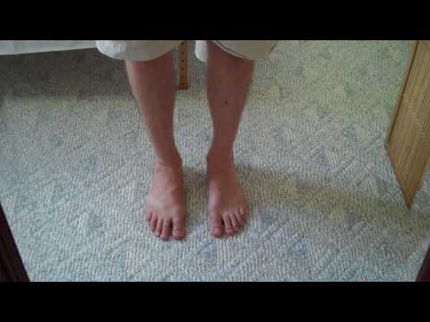 how to repair twisted ankle