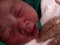 CT -- ???? New Born Baby (Day 1) CT -- ???? New Born Baby (Day 1)