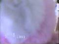 videos de Hospital Ward.wmv