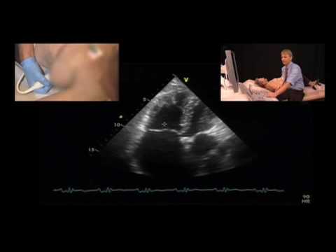 how to measure pulmonary artery pressure