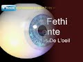 LES ANOMALIES DE L'OEIL.wmv
