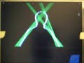 Real-Time Hough Transform on Xetal Real-Time Hough Transform on Xetal