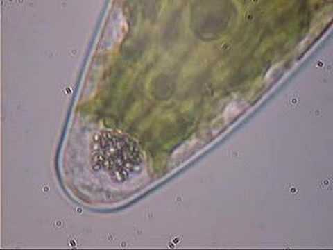 Crystals in Desmid Head