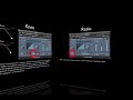 Logic Studio 8 - Lesson 3 Compression Logic Studio 8 - Lesson 3 Compression