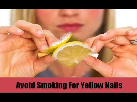 how to cure yellow nails
