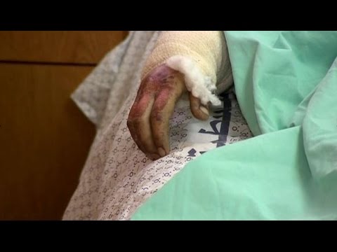 blast - A woman the BBC filmed being pulled from rubble is recovering in hospital - but none of the people with her survived, as Paul Adams reports. Subscribe to BBC News HERE http://bit.ly/1rbfUog...
