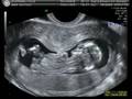 Baby McDee