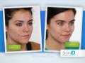 neutrogena katherine mcfee