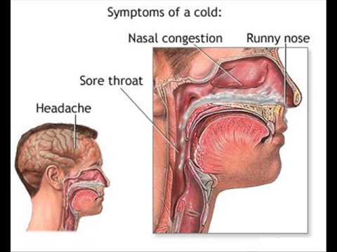 how to control rhinitis