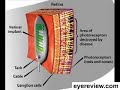 Macular Degeneration Research Macular Degeneration Research