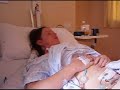 Bowel Obstruction Bowel Obstruction