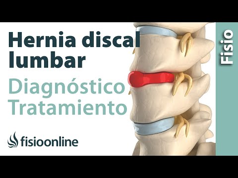 Si puede sheynogo osteocondrosis subir la presión arterial