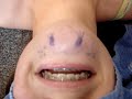 kinnetjes