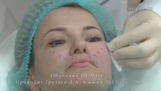 08.06.15 Обучение по нитевому лифтингу ОСМНТ OSMNT | ОСМНТ 08.06.15 Обучение по нитевому лифтингу ОСМНТ OSMNT | ОСМНТ