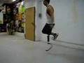 www.ortopediaaxis.com amputado femoral corriendo