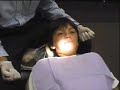 dr. christopher maulik, of scripps poway orthodontics, demonstrates the insertion of a rapid palatal expander (rpe).  used for orthodontics, to widen the upper jaw.