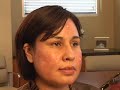 PLASTIC SURGERY:  CROSS ACNE SCARRING TREATMENTS  JOURNEY