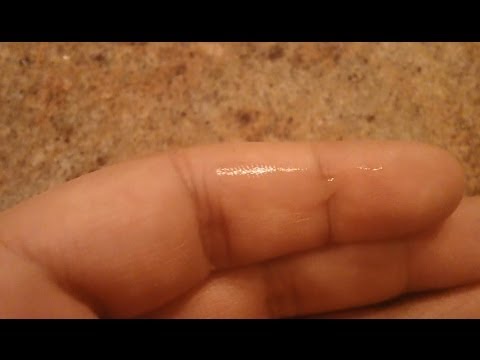 how to remove super glue from skin