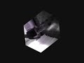 HE//Bre UNDERGROUND Shuffle