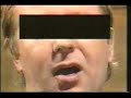 Tim Brooke-Taylor on Assaulted Nuts clip # 9