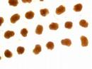 mexican-snail-embryos.html