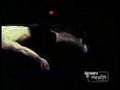 California Spine Center - Dr. Chiu - Discovery Health