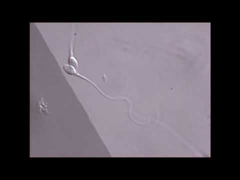 How long is a sperm picture