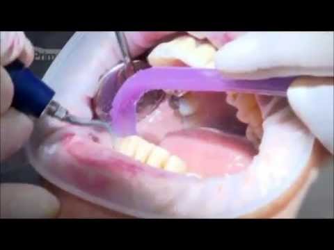 Dentální hygiena | Klinika Mediestetik