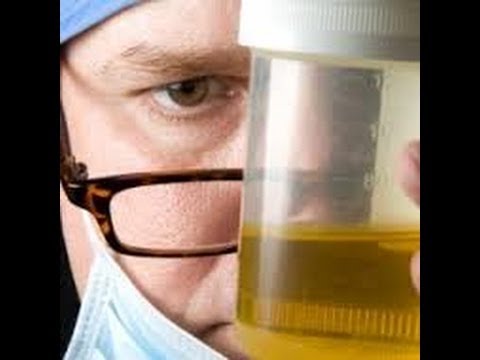 how to treat wbc in urine