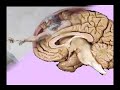 Michbrain