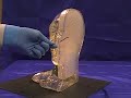Endo Head
