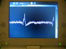 ECG Prototype 1